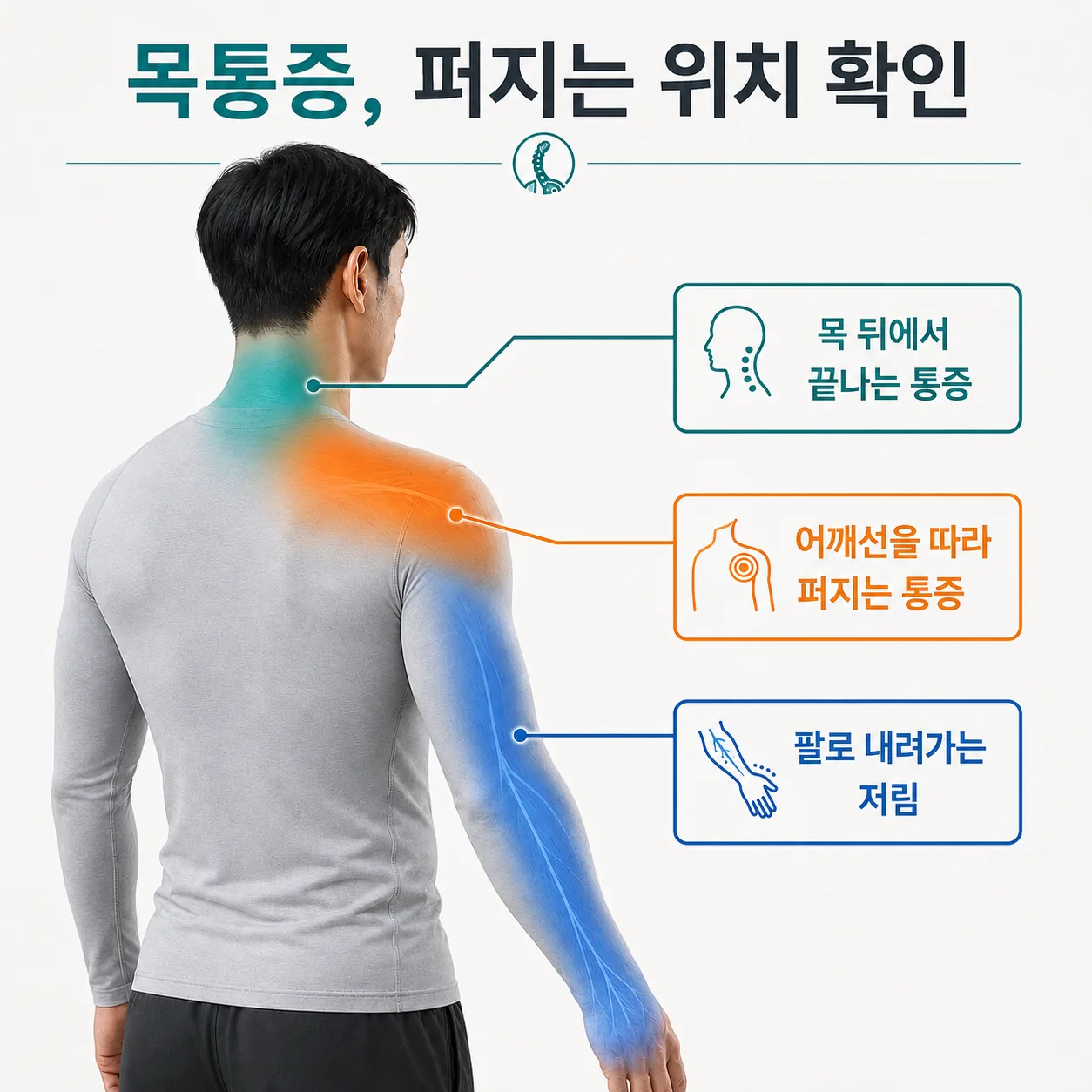 교통사고 후 목 통증이 목만인지 어깨까지인지 팔로 내려가는지 구분한 그림