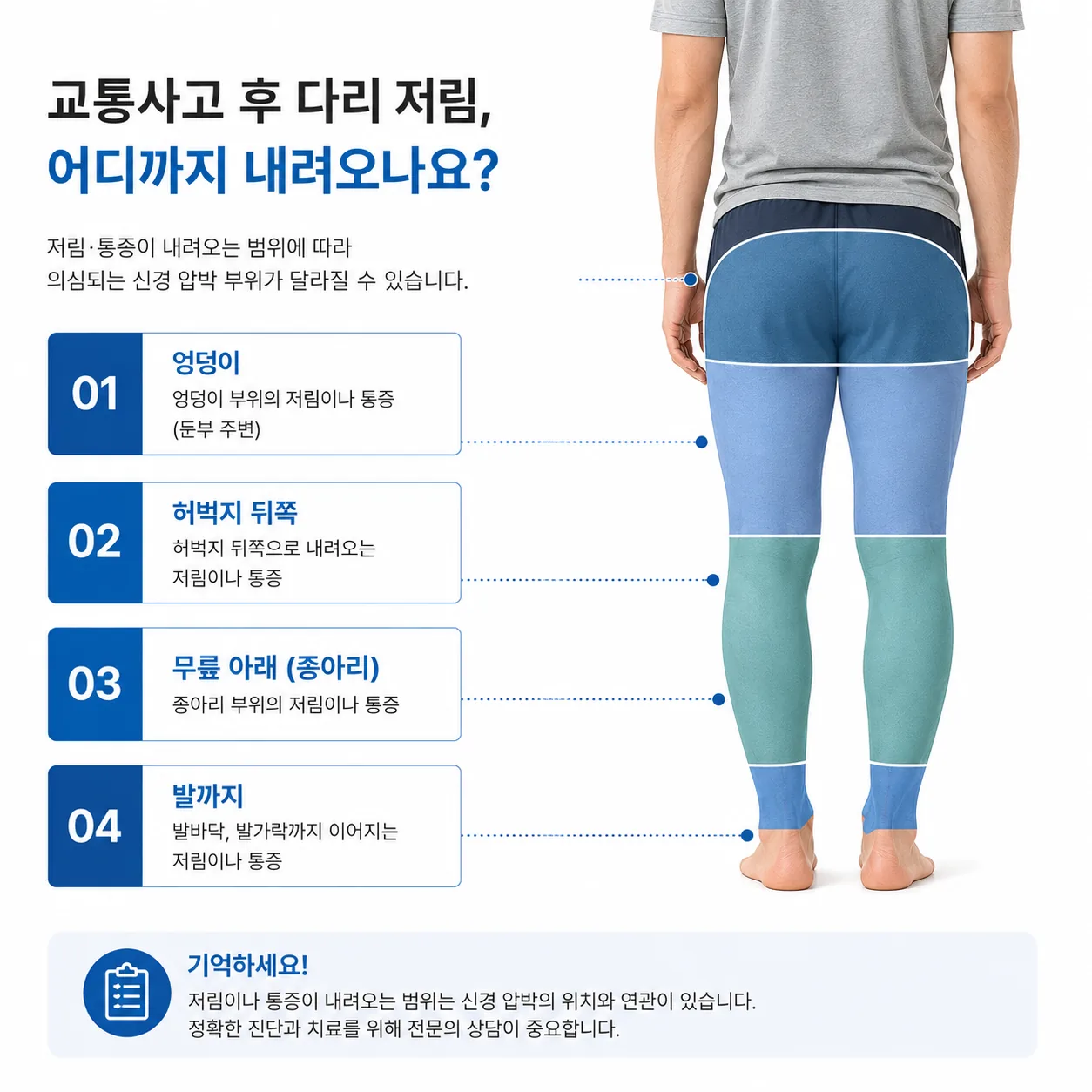 교통사고 후 다리 저림이 어디까지 내려오는지 네 구간으로 표시한 도해