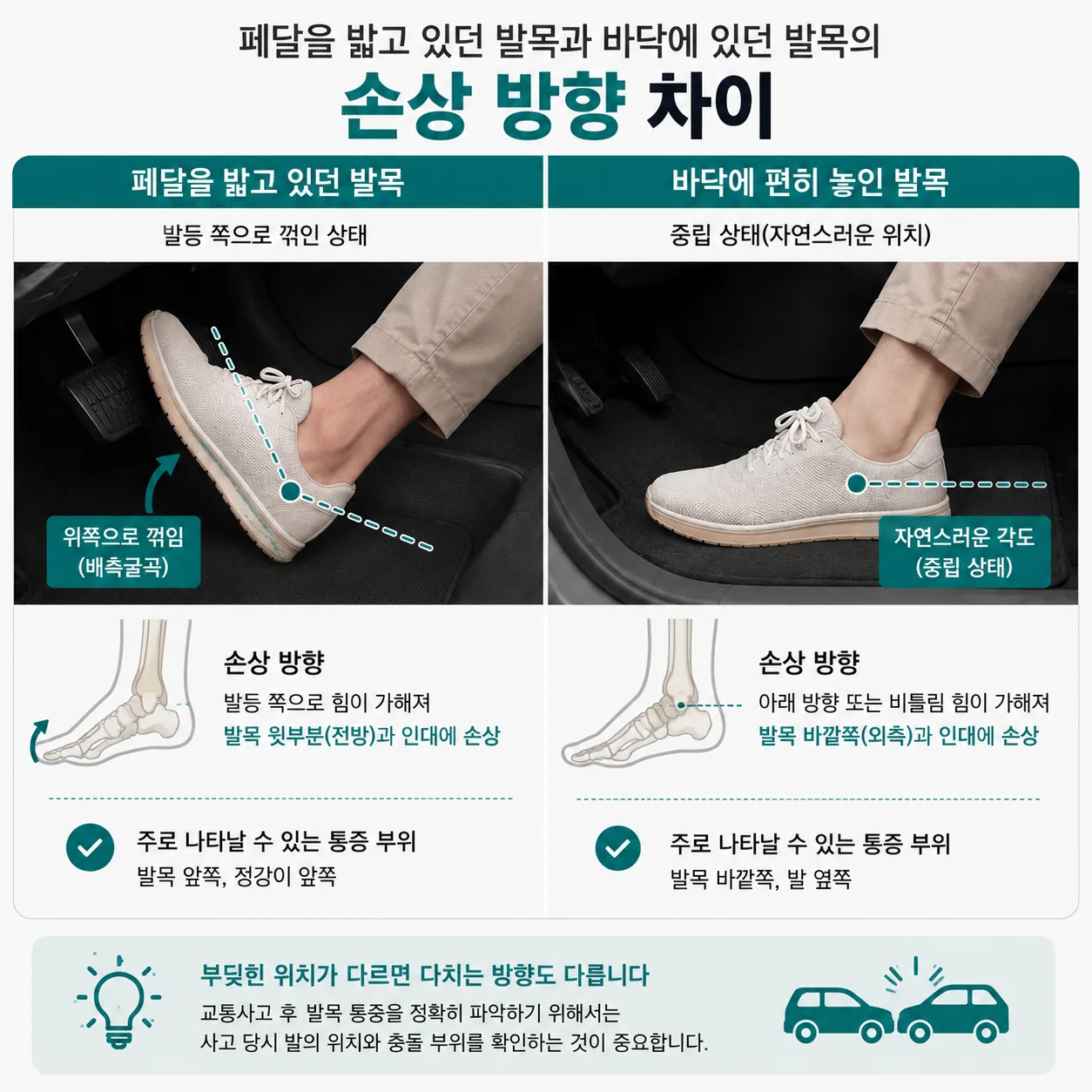 페달을 밟고 있던 발목과 바닥에 있던 발목의 손상 방향 차이