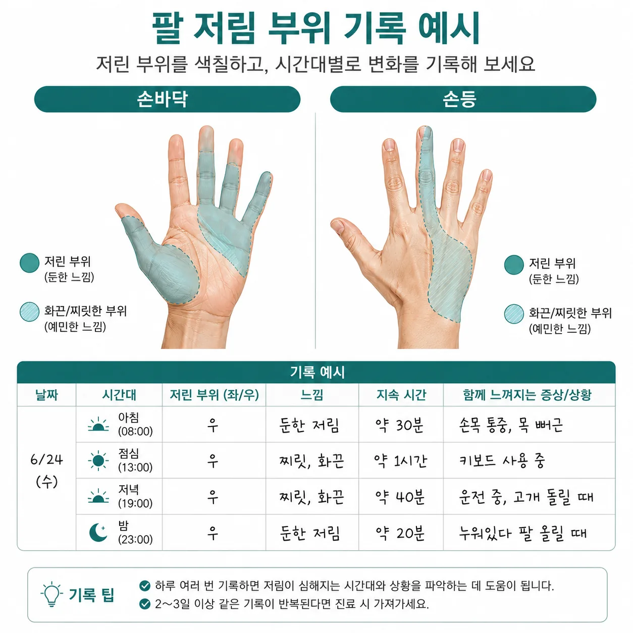 팔 저림 부위를 손 그림에 표시해 기록하는 자가 확인 방법