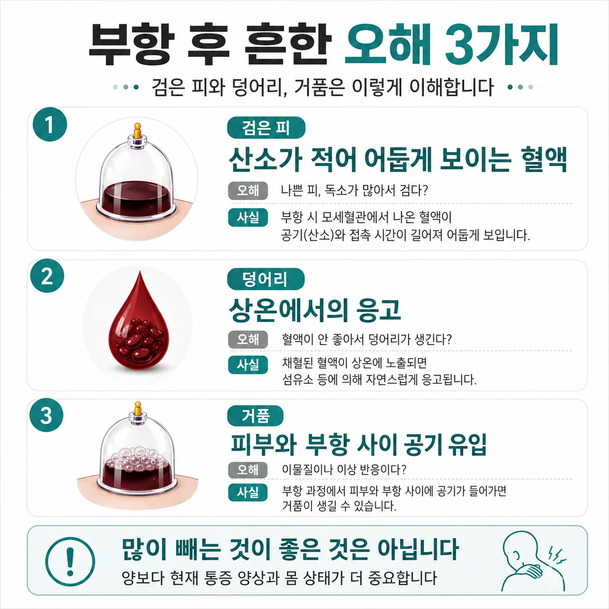 부항 후 검은 피와 덩어리, 거품에 대한 오해를 정정한 카드 도식