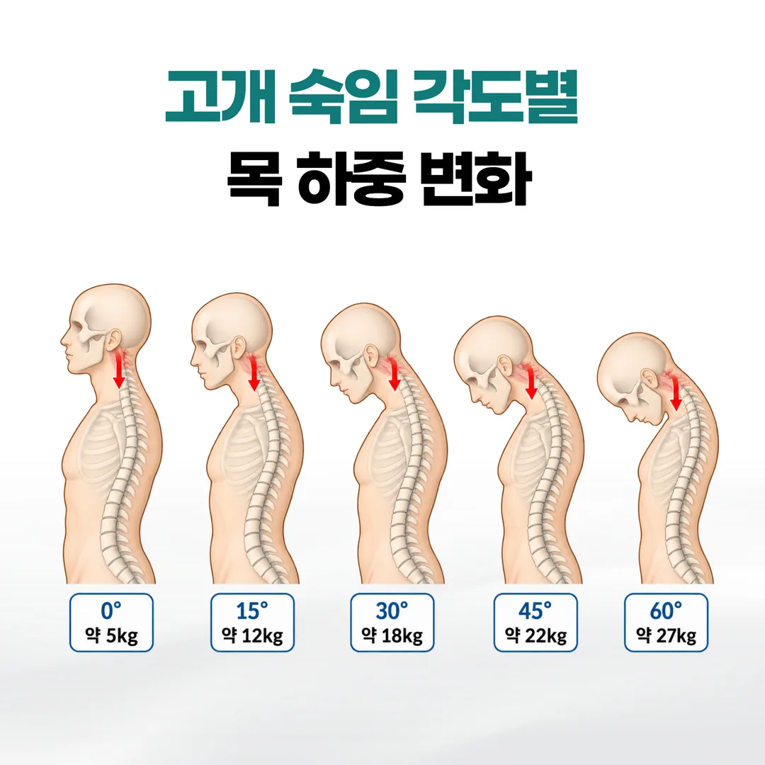 고개 숙임 각도별 목 하중 변화 도식